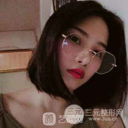 成都米蘭柏羽康春雨鼻部手術(shù)案例恢復(fù)日記~